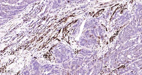 人环氧合酶2即用型免疫组化试剂盒-IHC0408H